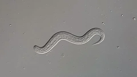 Nematode Parasite under microscopy view, 400x magnification 库存影片 306588790