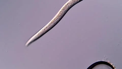 Nematode Parasite under microscopy view 스톡 동영상 310377208
