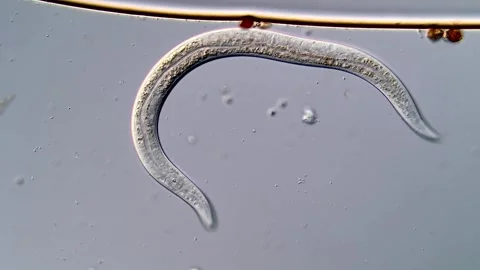 Nematode Parasite under microscopy view 400x magnification 库存影片 310386448