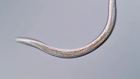 Nematode Parasite under microscopy view 400x 库存影片 310386714