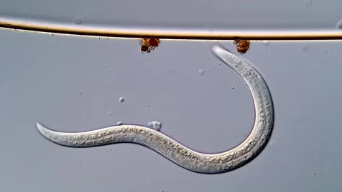 Nematode Parasite under microscopy view 400x 库存影片 310386917