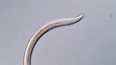 Nematode Parasite under microscopy view 400x magnification 스톡 동영상 310500762