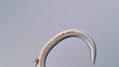 Nematode Parasite under microscopy view 400x magnification 스톡 동영상 310500766