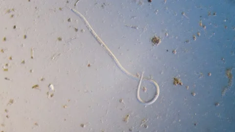 Nematode parasitic worm in microscope bright field Vidéo 164952866