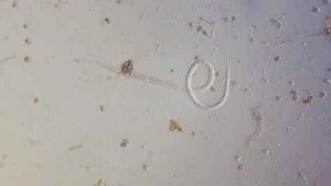 Nematode parasitic worm in microscope bright field 스톡 동영상 164953533