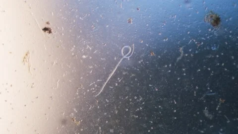 Nematode parasitic worm in microscope bright field Stock Footage 164953596