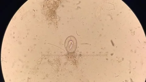 Nematode parasitic worm in microscope. larva inside ova movement Stock Footage 183190394