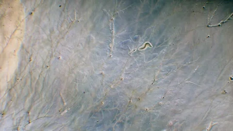 Nematode in Petri dish Stock Footage 312977596