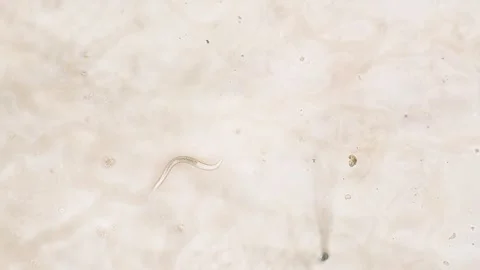 Nematode in Petri dish Stock Footage 312977694