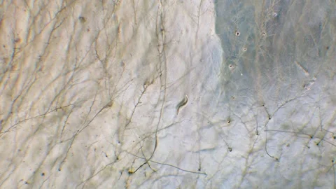 Nematode in Petri dish Stock Footage 312978241