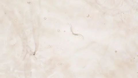 Nematode in Petri dish Stock Footage 312978541