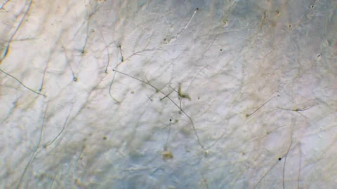 Nematode in Petri dish Stock Footage 312978577