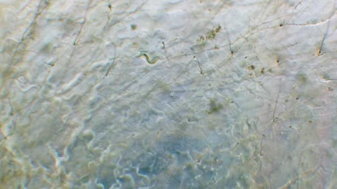Nematode in Petri dish Stock Footage 312985057