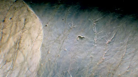 Nematode in Petri dish Stock Footage 312985254