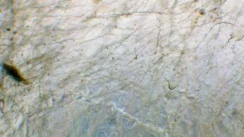 Nematode in Petri dish Stock Footage 312985347