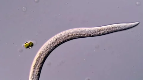 Nematode: Roundworm under microscope view 스톡 동영상 310357526