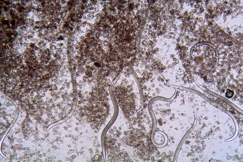 The nematode Steinernema feltiae under the microscope The nematode Steiner... Foto stock