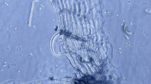 Nematode Trapped Microscope 400x Stock Footage