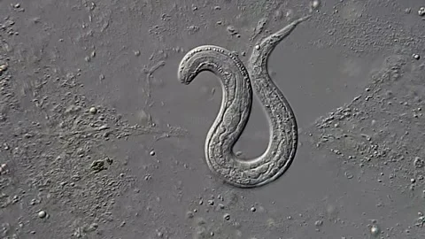 Nematode under DIC microscope view 400x Vídeos de archivo 306588718