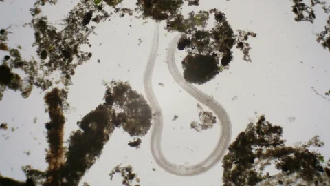 Nematode under the microscope in 4k Stock Footage 73832901