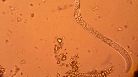 Nematode under microscope on red background Stock Footage