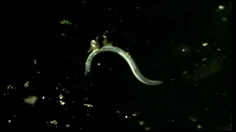 A Nematode Worm Video stock 1198009