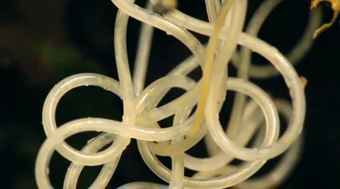 Nematode worm (roundworm) Stock Footage 1035452