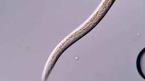 Nematode worm under DIC microscope view 스톡 동영상 310376850