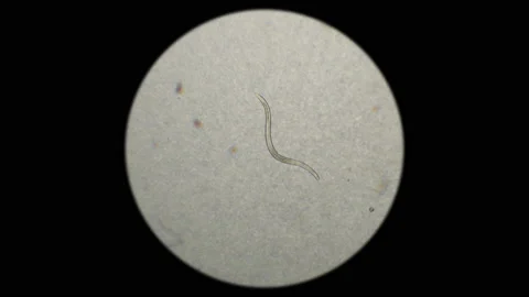 the nematode worm under a microscope | Stock Video | Pond5