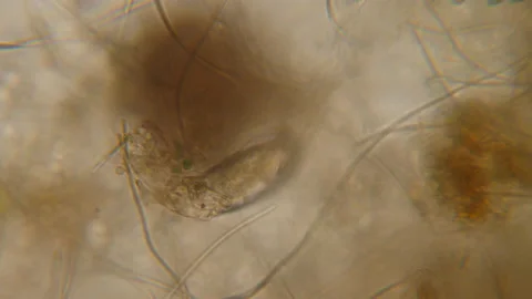 Nematode Worm Under Microscope, Parasites Among Roundworms: Roundworms, Pinwo Stock Footage 168292742