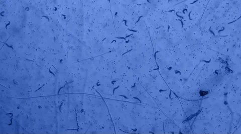 Nematode Worms Seen on Microscope at 40x Blue Filter Stock Footage 53853231