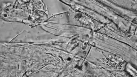 Nematodes and Worms in drinking Water under Microscope. Stock Footage 171197191