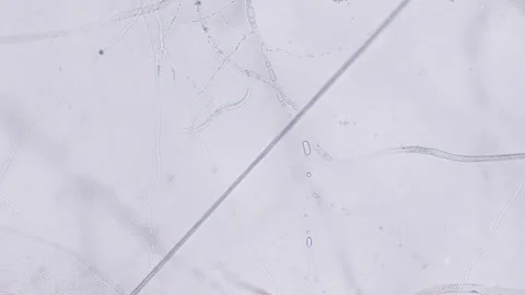 Nematodes Stock Footage 313174155