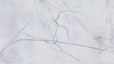 Nematodes Stock Footage 313174179