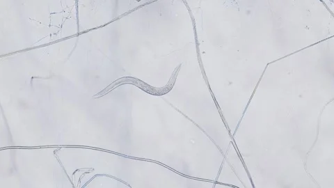 Nematodes Stock Footage 313174542