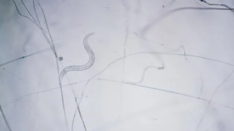 Nematodes Stock Footage 313174578