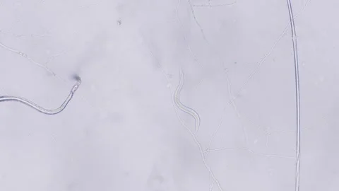 Nematodes Stock Footage 313174666
