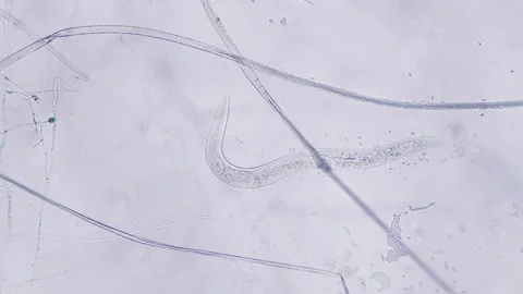 Nematodes Stock Footage 313174829