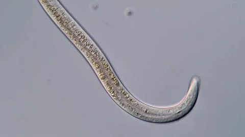 Nematodes larvae under microscope 400x magnification, Nematode Parasite Vídeos de archivo 310355561