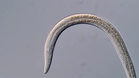 Nematodes Parasite larvae under microscope 400x 스톡 동영상 310356225