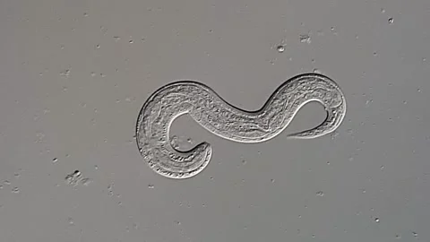 Nematodes Parasite in stool sample under microscopy view Vídeos de archivo 306588724