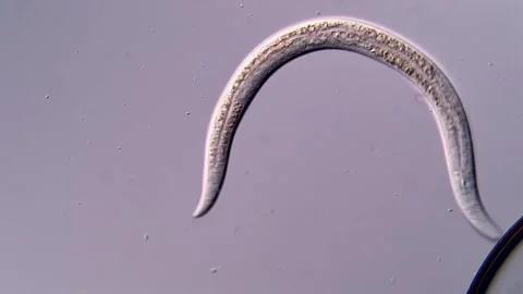 Nematodes under microscopy view 400x magnification 스톡 동영상 310383808
