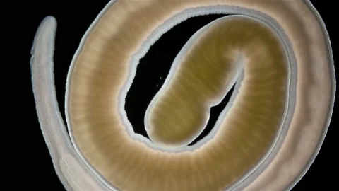 Nemertea worm Cephalothrix linearis under a microscope, class Palaeonemertea Stock Footage 233258029