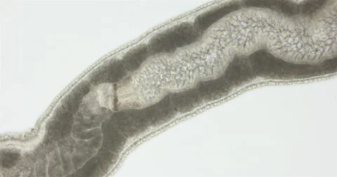 Nemertea worm under a microscope, class Hoplonemertea, order Monostilifera. Stock Footage 219544678