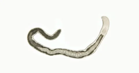 Nemertea worm under a microscope, class Hoplonemertea, order Monostilifera. Stock Footage 219546485