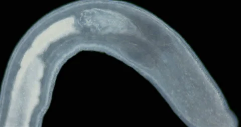 Nemertea worm under a microscope, class Hoplonemertea, order Monostilifera. Stock Footage 219550905