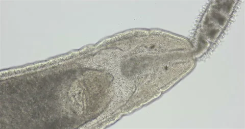 Nemertea worm under a microscope, class Hoplonemertea, order Monostilifera Stock Footage 219775119