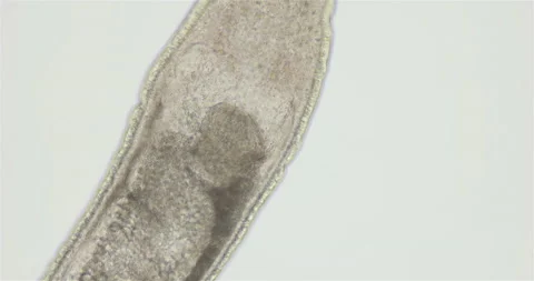 Nemertea worm under a microscope, class Hoplonemertea, order Monostilifera Stock Footage 219776011