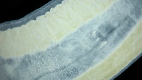 Nemertea worm under a microscope, class Hoplonemertea, order Monostilifera Stock Footage 229759698
