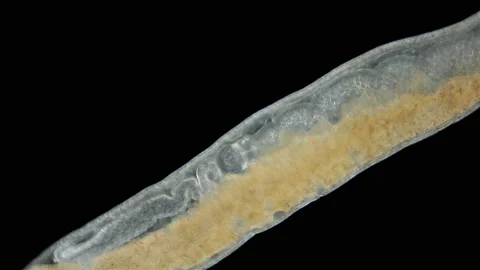 Nemertea worm under a microscope, class Hoplonemertea, order Monostilifera. Stock Footage 232651265